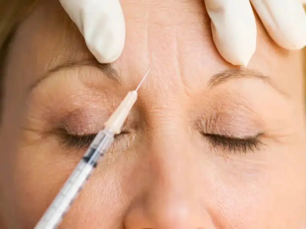 botox, Fine Lines and Wrinkles