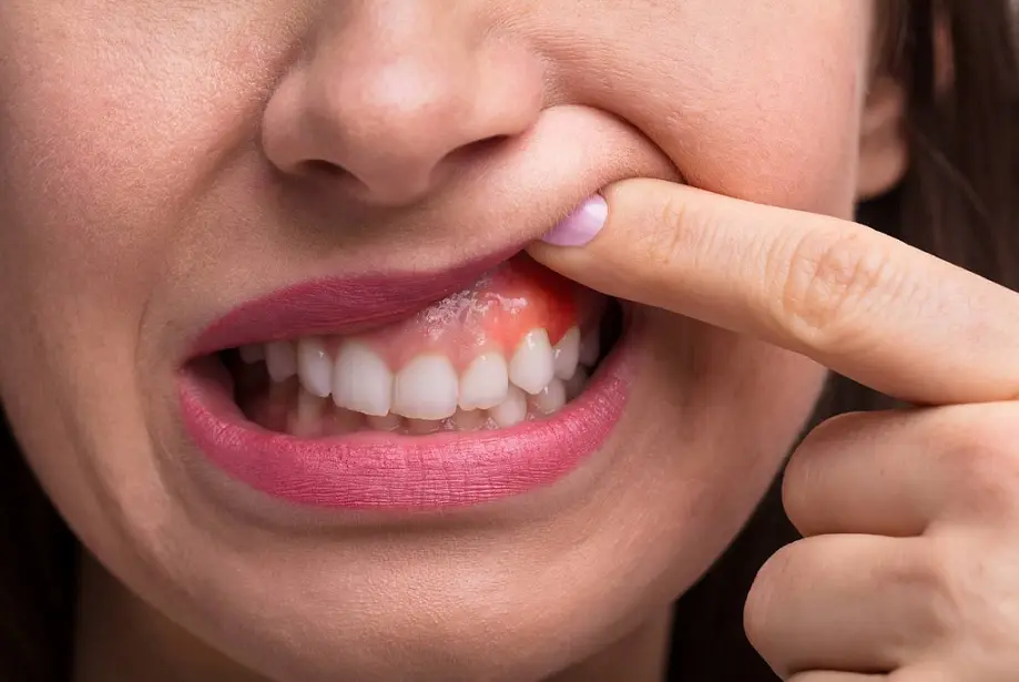 warning signs your kidneys are failing, 7 warning signs that your kidneys are toxic, don't ignore the warning signs your kidneys need your help, kidneys warning signs, kidney problem warning signs you must not ignore, signs your kidneys are crying for help, 10 signs your kidneys are crying for help!!, strange signs your kidneys are crying for help, kidney warning signs, kidney disease warning signs, 12 signs that your kidneys need help, warning signs of kidney disease, warning signs of kidney failure