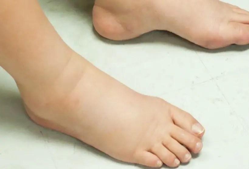 warning signs your kidneys are failing, 7 warning signs that your kidneys are toxic, don't ignore the warning signs your kidneys need your help, kidneys warning signs, kidney problem warning signs you must not ignore, signs your kidneys are crying for help, 10 signs your kidneys are crying for help!!, strange signs your kidneys are crying for help, kidney warning signs, kidney disease warning signs, 12 signs that your kidneys need help, warning signs of kidney disease, warning signs of kidney failure